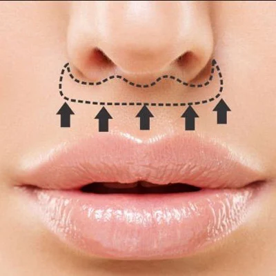 جراحی لیفت سنترال