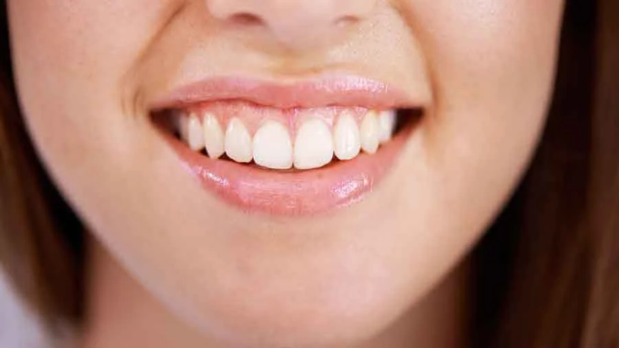 جراحی لبخند لثه ای