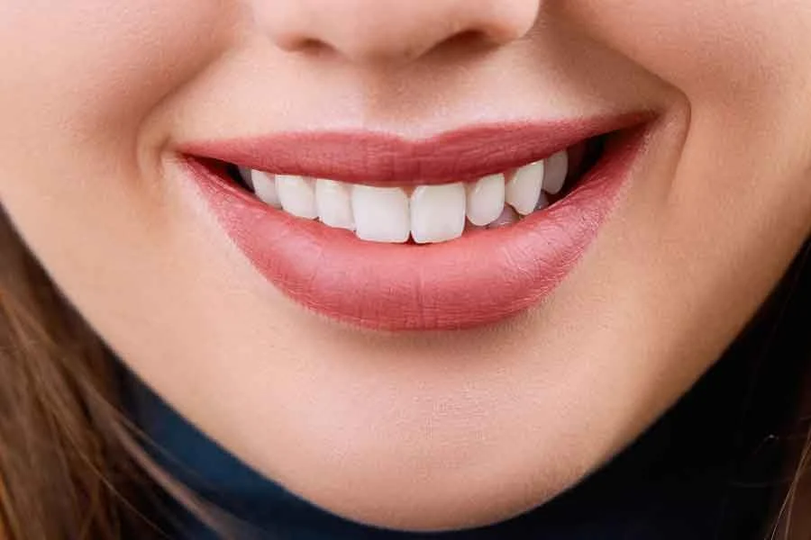 قیمت جراحی لبخند لثه ای